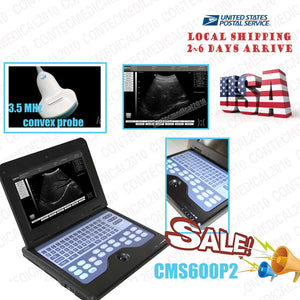 USA Ship Smart Laptop Ultrasound Scanner Diagnostic System with 3.5 convex probe