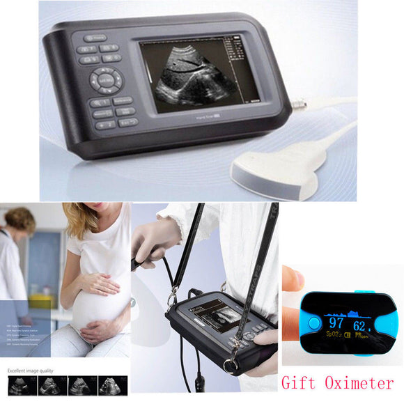 Portable Medical Ultrasound Scanner System Convex Probe Abdominal Free Oximeter