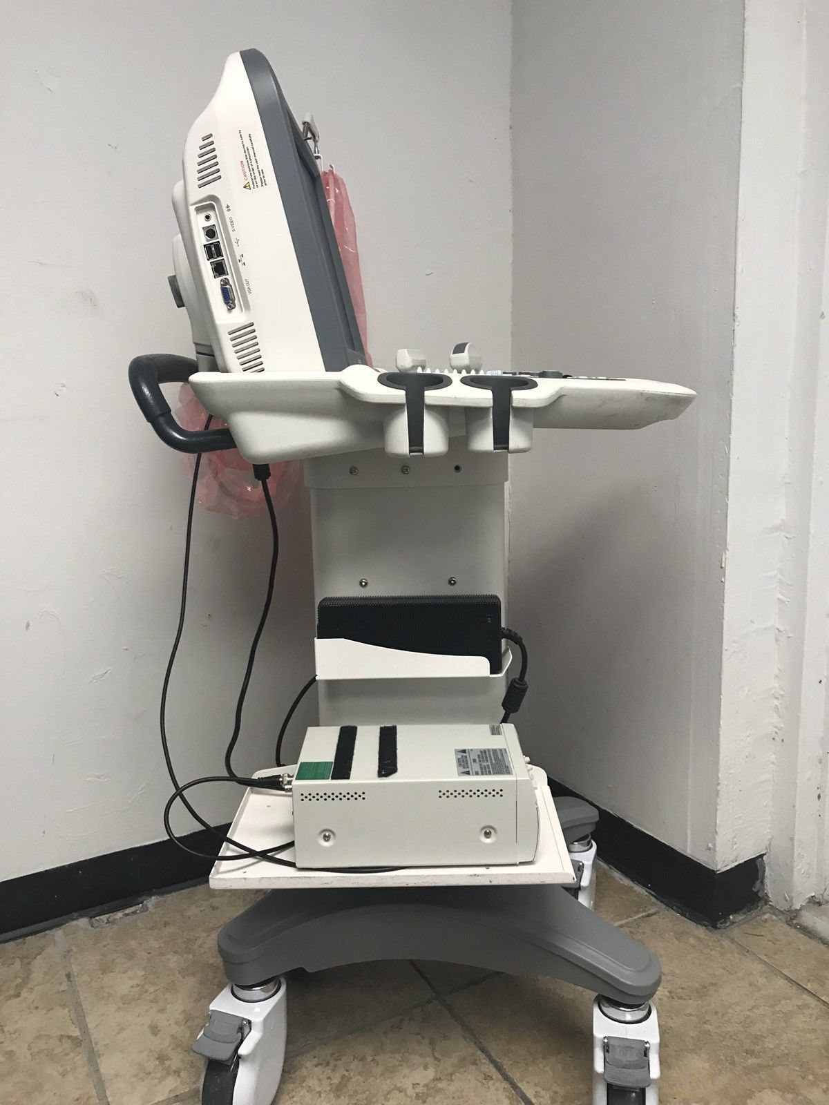 2013 Sonoscape S2 Ultrasound With Vascular, Abdominal Probes DIAGNOSTIC ULTRASOUND MACHINES FOR SALE