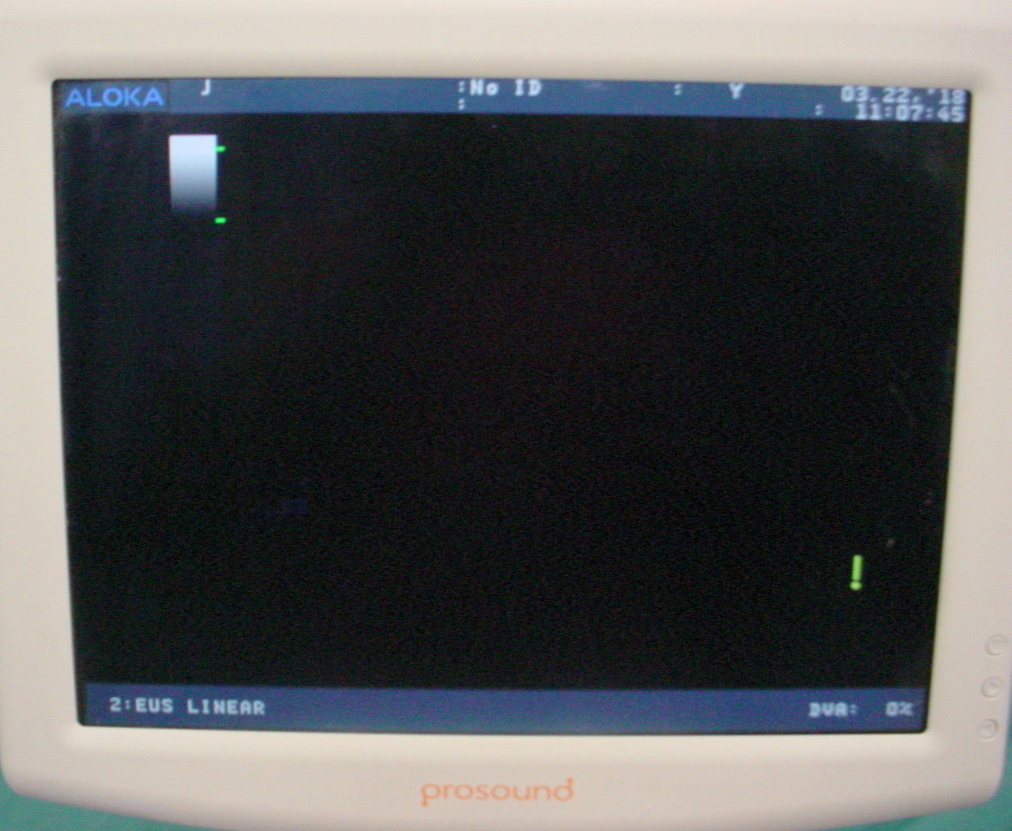 Aloka Prosound SSD-a5 sv Ultrasound System, Cart Based ~ No Probes DIAGNOSTIC ULTRASOUND MACHINES FOR SALE