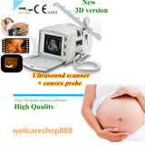 Digital Diagnose System Ultrasound Scanner Monitor Convex+Linear Probe 3D Image