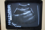 ATL Ultrasound Probes Convex Array 3.5 MHz Curved Linear Array
