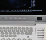 Portable Digital Ultrasound Machine Scanner System 7.5 Mhz Linear Probe Free 3D