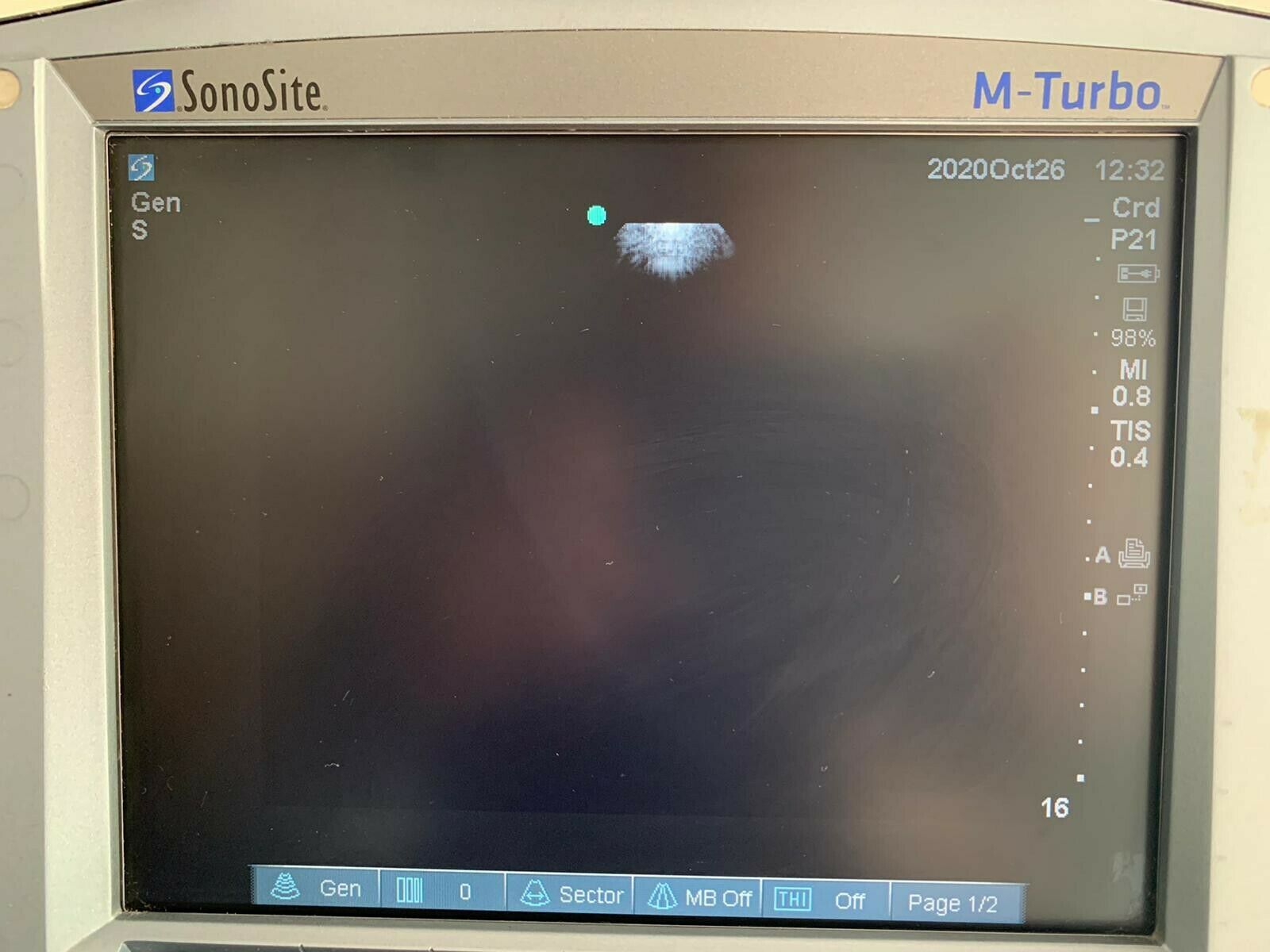 Sonosite P21x Ultrasound Probe Cardiac Transducer for Sonosite M-Turbo or Edge DIAGNOSTIC ULTRASOUND MACHINES FOR SALE