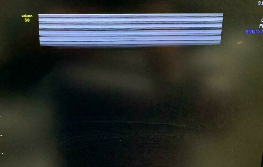 GE Vivid iQ Premium Portable Ultrasound System w/ M5Sc-Rs & 9L-Rs Probes DIAGNOSTIC ULTRASOUND MACHINES FOR SALE