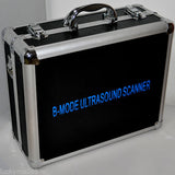 Medical Laptop Machine Ultrasound Scanner Convex/Linear/Transvaginal Probe + 3D 190891044686
