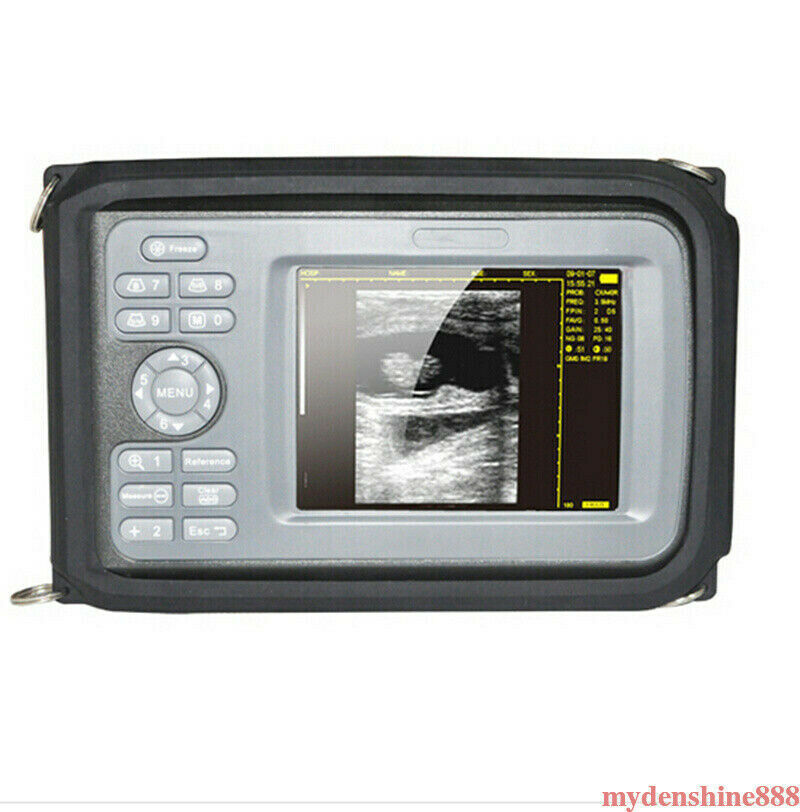 Portable Handheld Human Ultrasound Scanner Machine + 3.5mhz Convex Probe + Case DIAGNOSTIC ULTRASOUND MACHINES FOR SALE