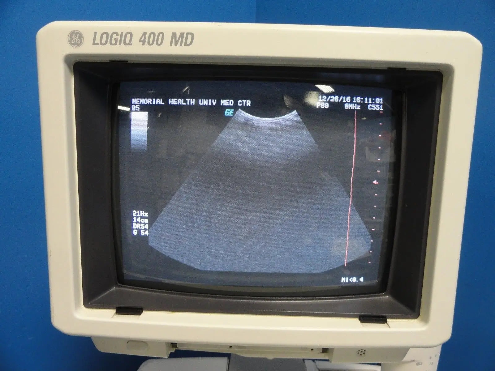 GE Logiq 400 MD Soft Pack Ultrasound W/ C364, C551, 739L  Probes & Printer~12413 DIAGNOSTIC ULTRASOUND MACHINES FOR SALE