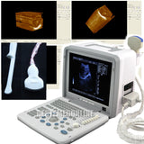 12" LED Full Digital Portable Ultrasound Scanner +3.5M Convex +7.5M Linear probe 190891974327