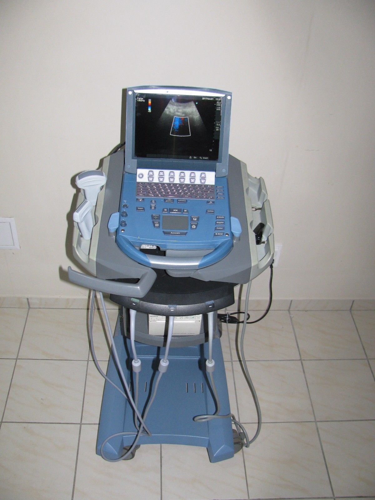 Ultrasound machine Sonosite Micromaxx with cart and three probes DIAGNOSTIC ULTRASOUND MACHINES FOR SALE