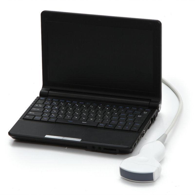 Full Digital Quality Images Ultrasound Scanner Convex +Linear Probe 3D Clear CE DIAGNOSTIC ULTRASOUND MACHINES FOR SALE