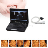 10.1'' LCD Preganancy Check Machine Ultrasound scanner with 7.5MHz Linear probe