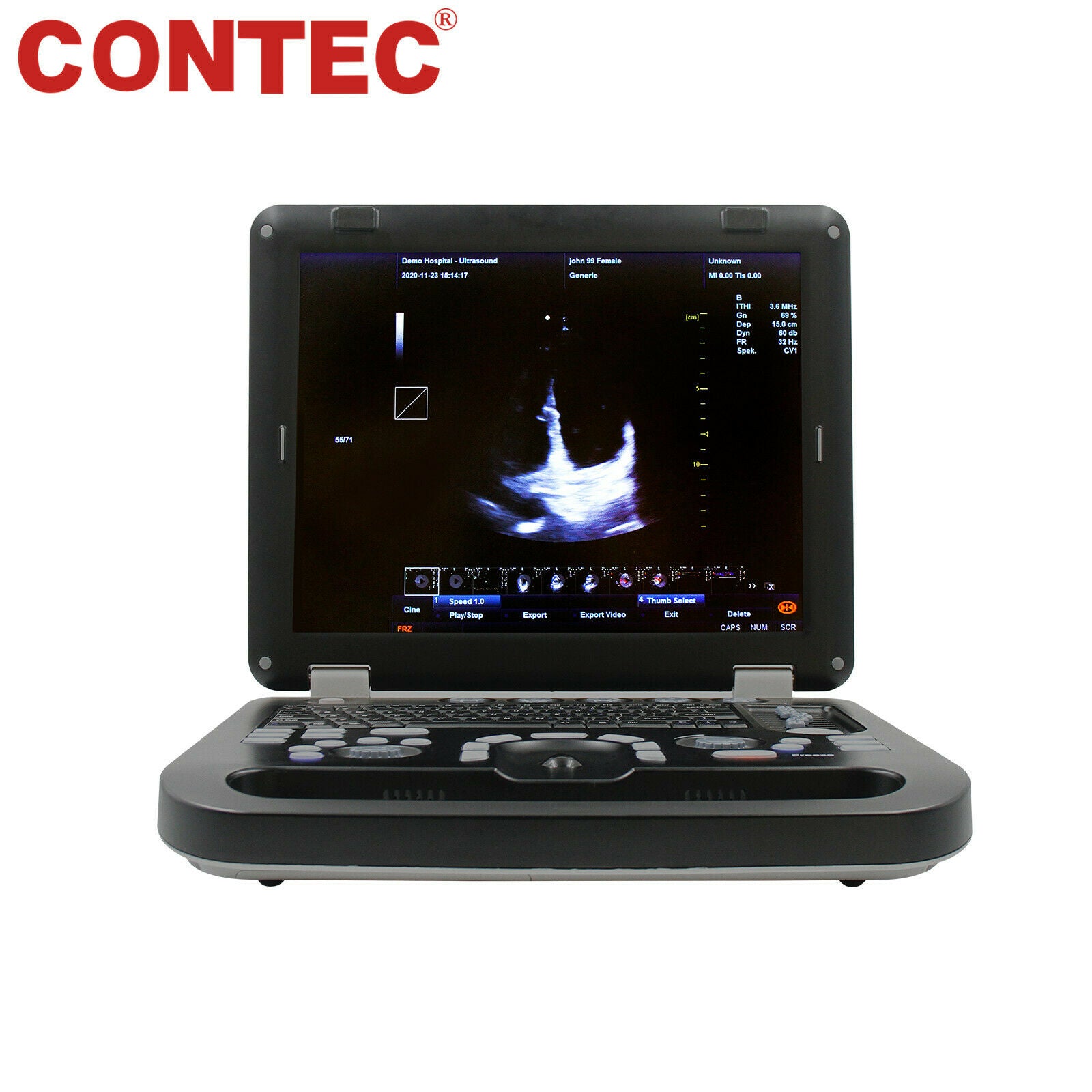 New Color Doppler Ultrasound Scanner Portable Laptop Machine with Rectal Probe DIAGNOSTIC ULTRASOUND MACHINES FOR SALE