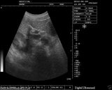 Veterinary B-Ultrasound Scanner/Machine  Micro-convex Array Probe VET/Animals 3D 190891949295