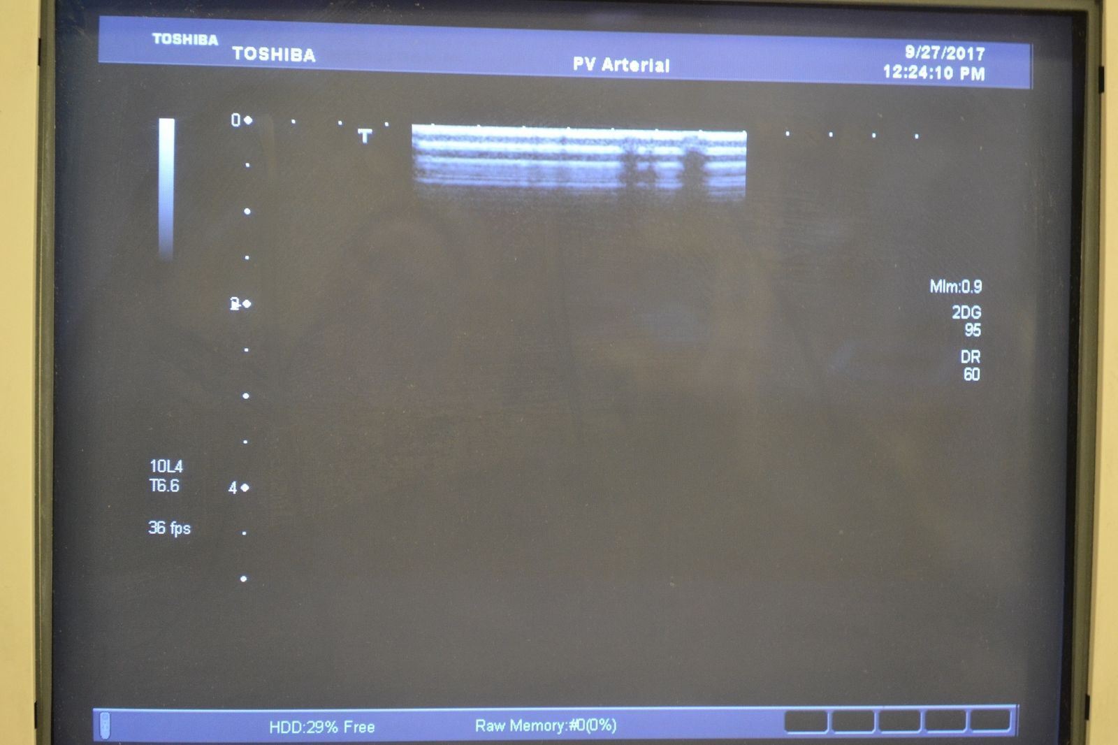 Toshiba  Xario PLT-604AT 9.2-4MHz Linear Ultrasound Transducer Probe DIAGNOSTIC ULTRASOUND MACHINES FOR SALE