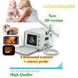 Hot Digital Diagnose Ultrasound Scanner Machine with Convex Probe +3D Software 190891792440
