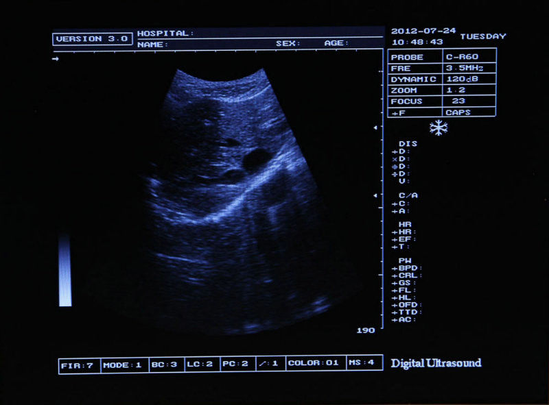 Digital Portable Ultrasound Scanner Machine + 7.5MHz Linear Probe 3D UPS Fast 190891523907 DIAGNOSTIC ULTRASOUND MACHINES FOR SALE