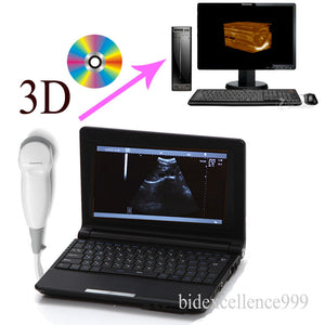 Top Full Digital Laptop Ultrasound Scanner Monitor+ Micro-Convex Probe 3D Image