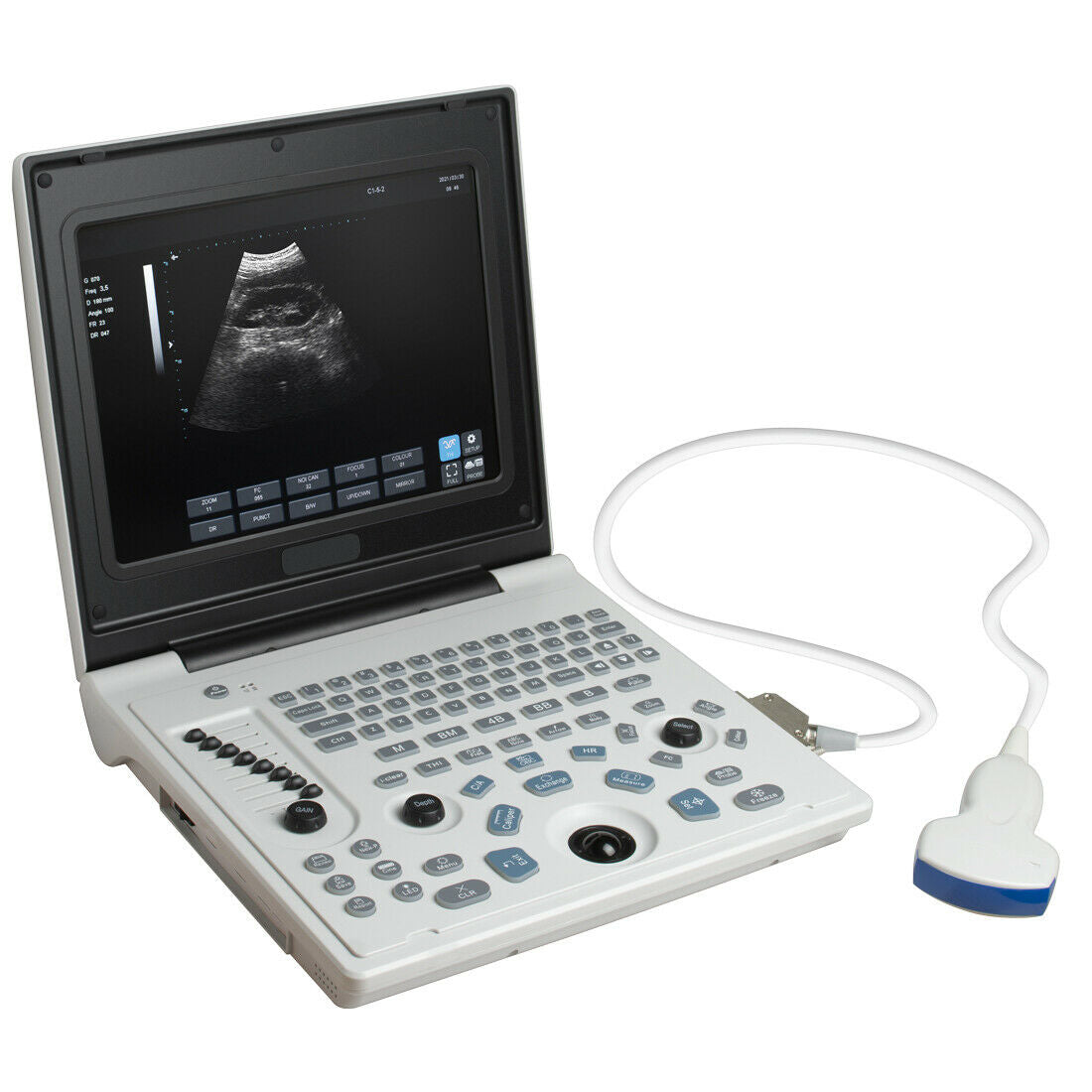 Portable 12 inch Digital Ultrasound Scanner Diagnostic Heart Rate System 3.5MHz DIAGNOSTIC ULTRASOUND MACHINES FOR SALE