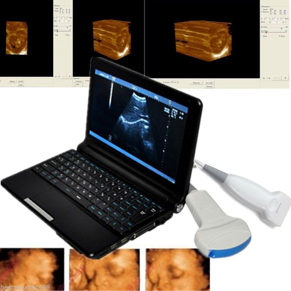 Top Digital Laptop Ultrasound Scanner PC System Convex Linear Probes 3D Version 190891763723