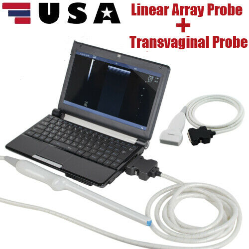 Pro Digital Laptop Ultrasound Machine Linear Array Probe + Transvaginal Probe DIAGNOSTIC ULTRASOUND MACHINES FOR SALE