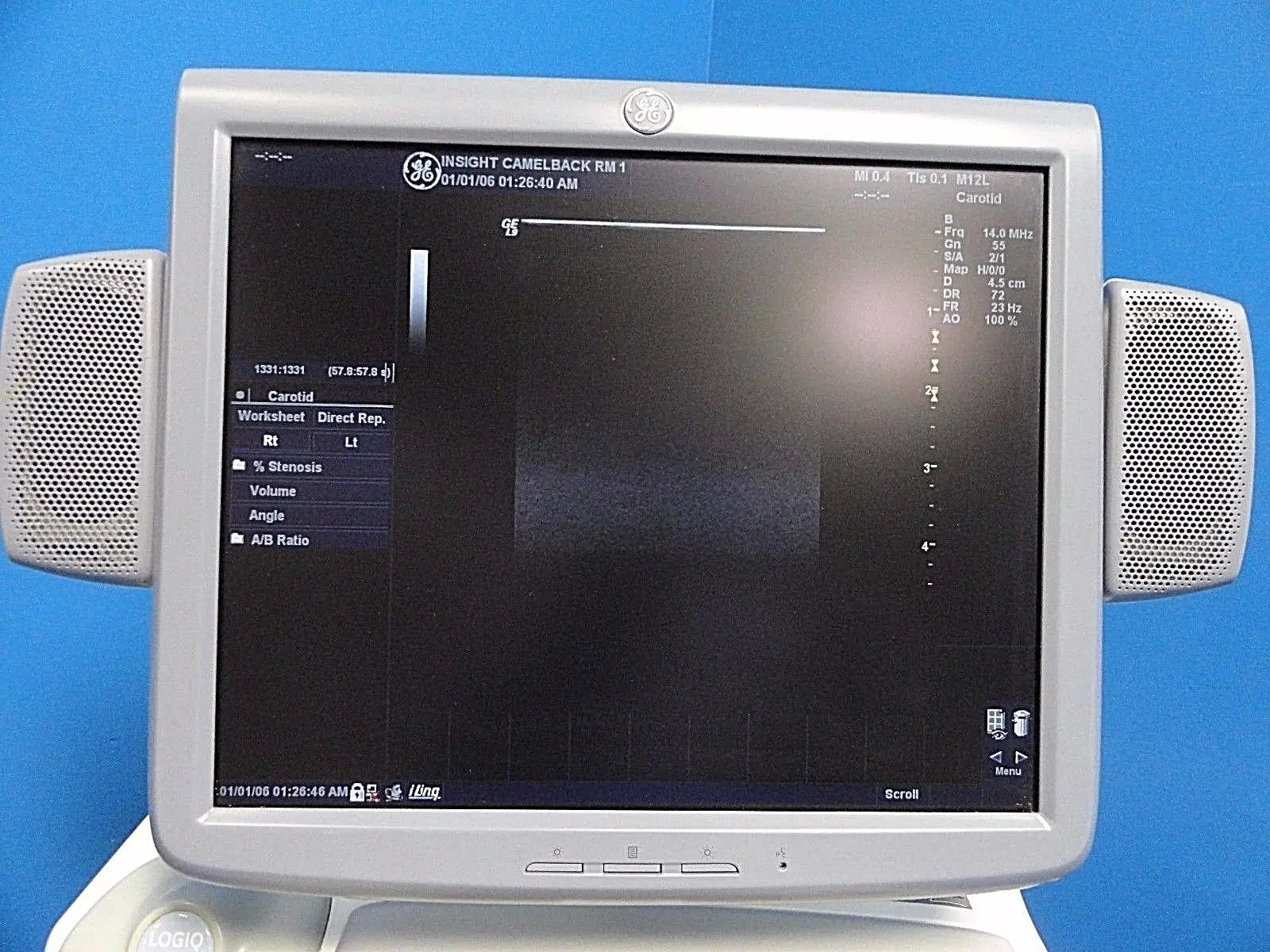 GE M12L P/N 2294512 Linear Array Ultrasound Probe for Logiq & Vivid Series~13722 DIAGNOSTIC ULTRASOUND MACHINES FOR SALE