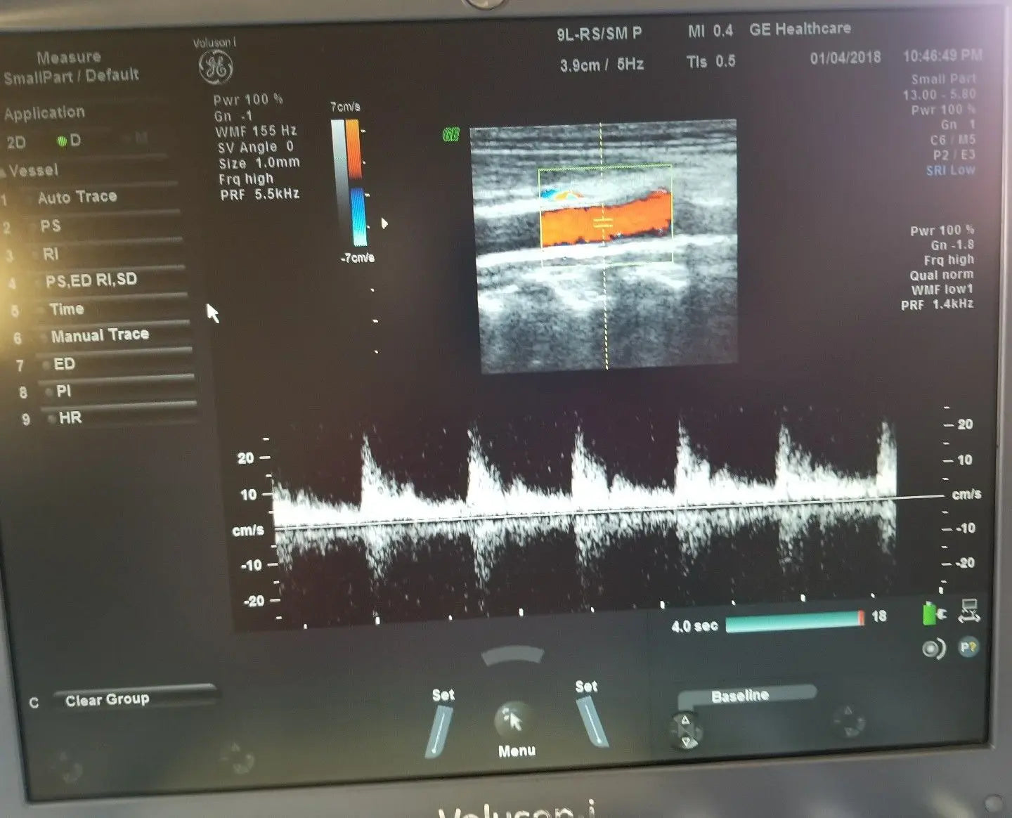 GE 9L-RS Ultrasound Probe / Transducer DIAGNOSTIC ULTRASOUND MACHINES FOR SALE