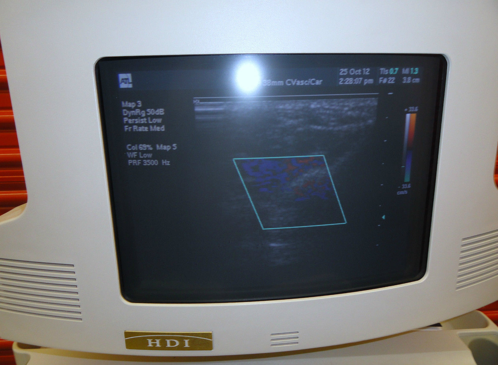 ATL HDI-3000 ULTRASOUND W/ L7-4 & L10-5 VASCUALR-SMALL PARTS PROBES PRINTER &VCR DIAGNOSTIC ULTRASOUND MACHINES FOR SALE