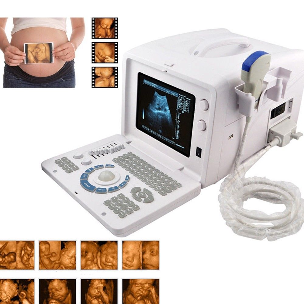 Digital Ultrasound machine Scanner  Convex& linear Probe +3D Software CE Sale 190891211668 DIAGNOSTIC ULTRASOUND MACHINES FOR SALE