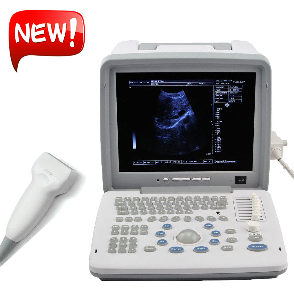 Digital Portable Ultrasound Scanner Machine + 7.5MHz Linear Probe 3D UPS Fast 190891523907 DIAGNOSTIC ULTRASOUND MACHINES FOR SALE