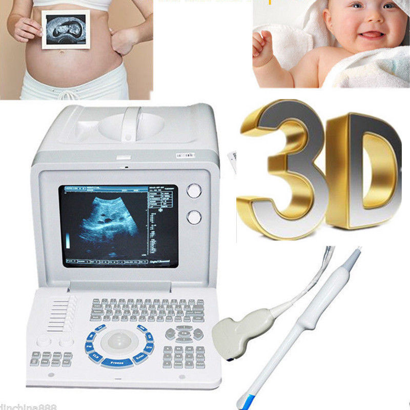 Portable+3D Version Digital Ultrasound System Scanner Convex +Transvaginal Probe DIAGNOSTIC ULTRASOUND MACHINES FOR SALE