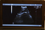 Laptop Ultrasound Scanner/Machine Convex+Vascular Linear Probes Transducer 3D AA 190891879639