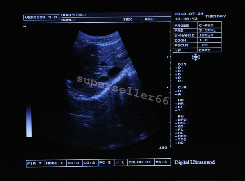 Digital LCD Ultrasound Scanner & Convex,Transvaginal, Linear 3 Probes & Gift 3D DIAGNOSTIC ULTRASOUND MACHINES FOR SALE