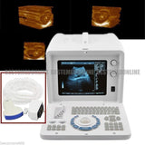 Portable Digital Ultrasound machine Scanner+3.5Mhz convex Probe+*3Dworkstation** 190891888099