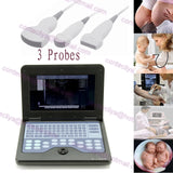 CE Digital Ultrasound Scanner Laptop Machine Diagnostic System Optional 4 Probe