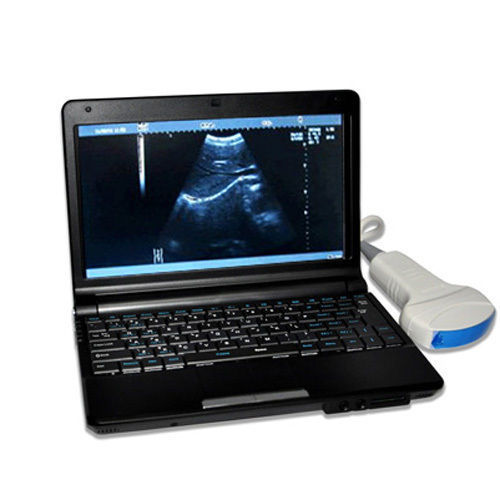 Digital Laptop Notebook Ultrasound Scanner+Convex+Linear+TranVagin Probe 10" LCD DIAGNOSTIC ULTRASOUND MACHINES FOR SALE