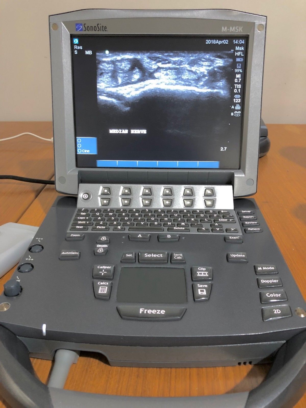 Sonosite M-Turbo Portable Ultrasound System MSK 2013 Model DIAGNOSTIC ULTRASOUND MACHINES FOR SALE