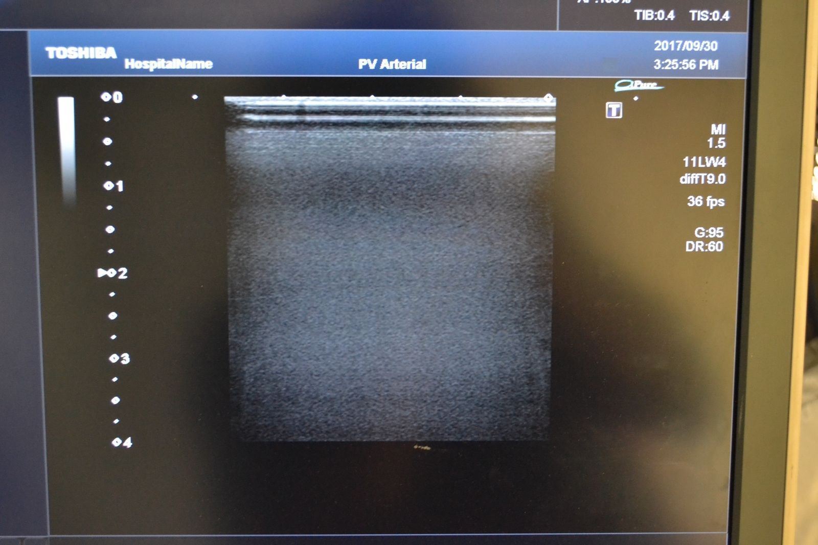 Toshiba Artida PLT-704SBT 11-4.8MHz Linear Ultrasound Transducer Probe  J1625 DIAGNOSTIC ULTRASOUND MACHINES FOR SALE