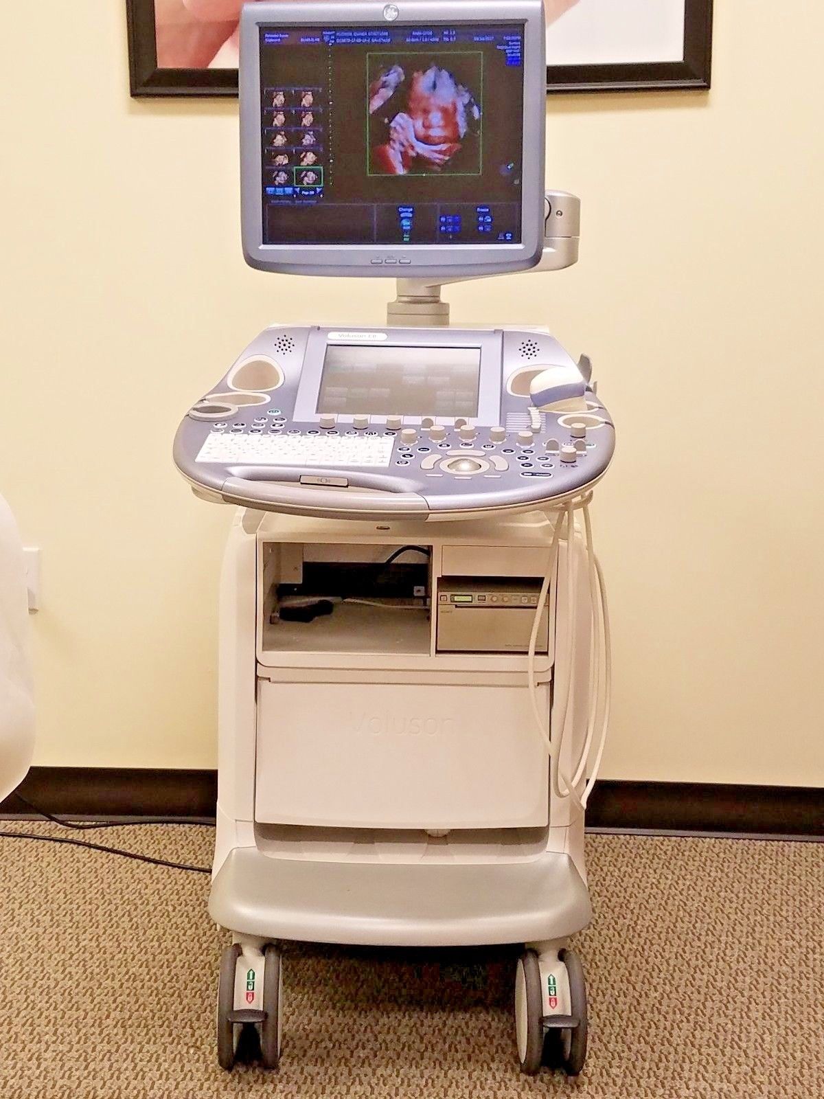 GE VOLUSON E8 HD LIVE 3D/4D, + PROBE RAB6-D DIAGNOSTIC ULTRASOUND MACHINES FOR SALE