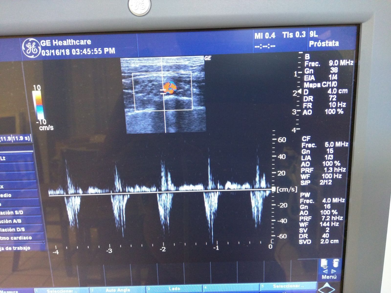 GE LOGIQ P5 2007 ULTRASOUND SYSTEM W/3 PROBES 4C CONVEX & 9L LINEAR & E8C TRANSV DIAGNOSTIC ULTRASOUND MACHINES FOR SALE