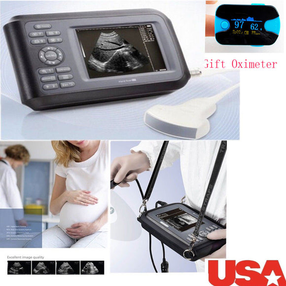 USA! Medical Ultrasound Scanner Machine Convex Probe Abdominal Scan + Oximeter 190891827272