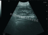 10.1'' Ultrasound Scanner +Convex,Linear,Trans Vaginal,3 Probes+Terminal Printer 190891746344