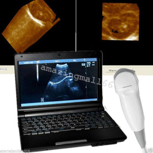 Full Digital Laptop Ultrasound Scanner Probe Micro-Convex Cardiac Probe w 3D Kit 190891462879