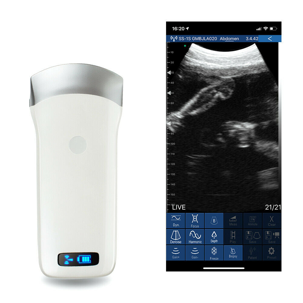Portable Ultrasound Scanner Convex Array Probe 3.5Mhz 80 Elements +16 Channel CE DIAGNOSTIC ULTRASOUND MACHINES FOR SALE