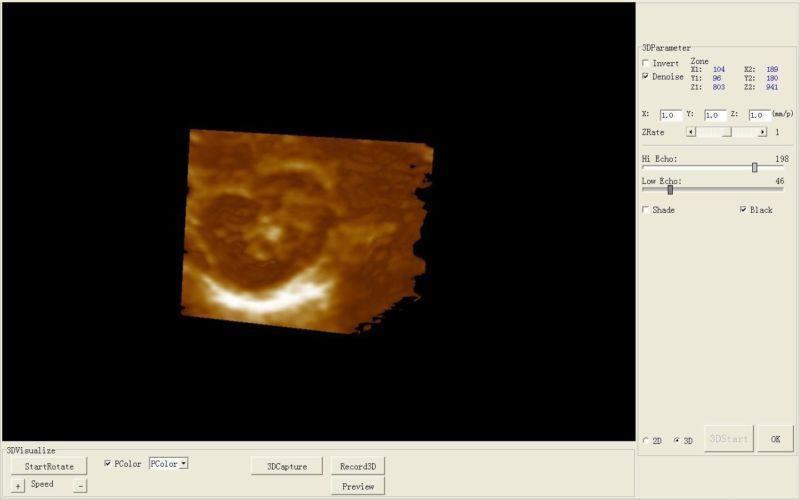 Medical Ultrasonic Ultrasound Machine Covex +Linear+Transvaginal 3 Probes 3D AA DIAGNOSTIC ULTRASOUND MACHINES FOR SALE