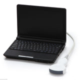 Hospital Laptop Machine Ultrasound Scanner Convex/Linear/Endovaginal Probe +Case 190891044686