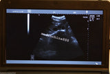 New 10.1'' Ultrasound Scanner With Convex+Linear+Transvaginal+Micro-convex Probe