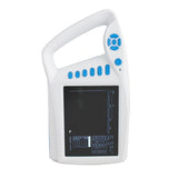 7" Full Digital Palm Ultrasound Scanner Diagnostic Machine Linear Probe USB Sale