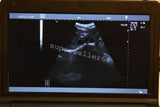 Ultrasound Scanner Monitoring+Convex,Linear,Trans Vaginal,Micro-convex 4 Probes