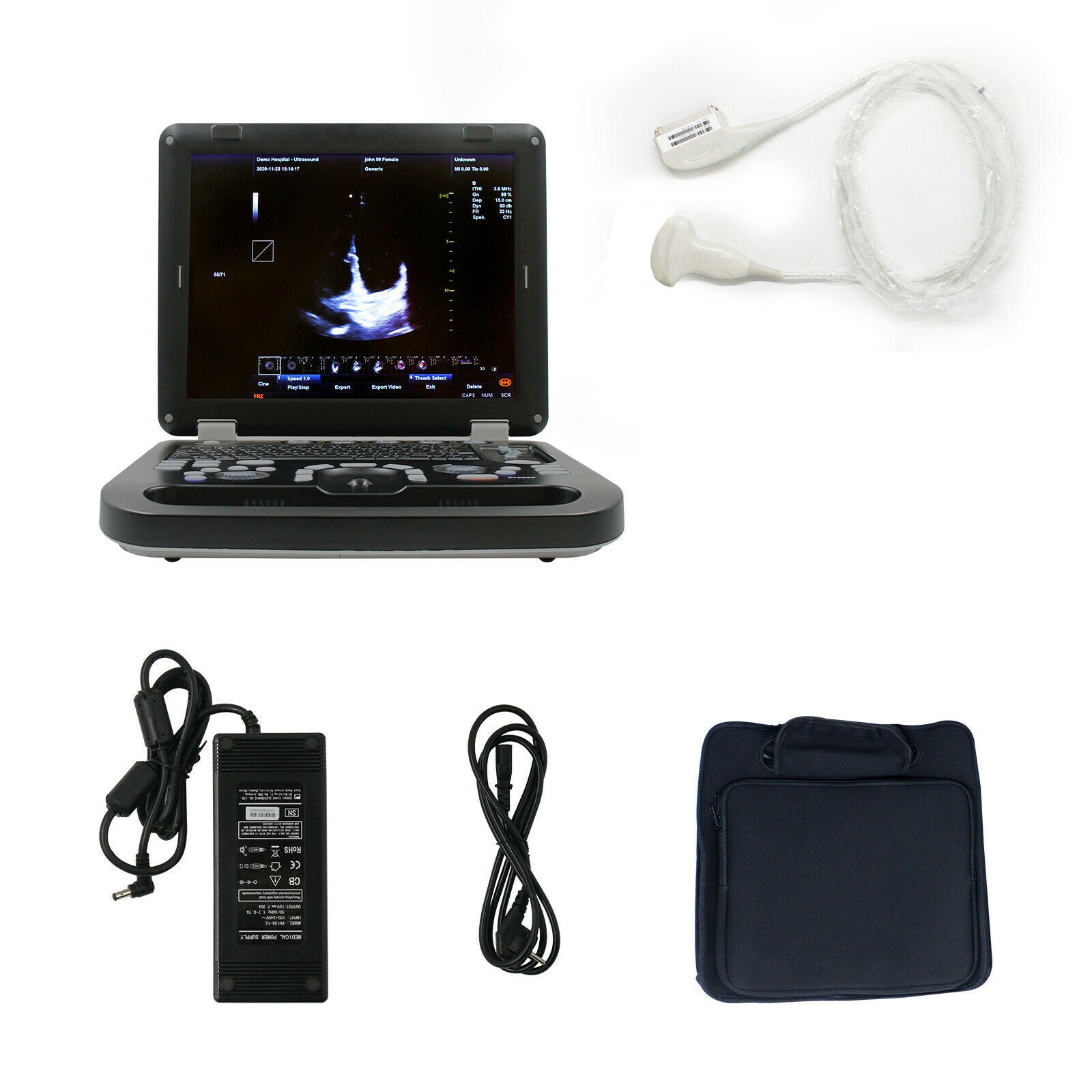 Portable Ultrasound Scanner Color Doppler Machine+ Convex Probe, PW CW,USB+Video DIAGNOSTIC ULTRASOUND MACHINES FOR SALE